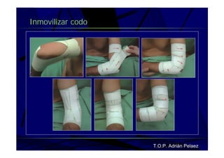 Vendaje Funcional Miembro Superior