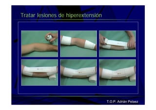 Vendaje Funcional Miembro Superior