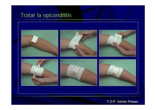 Vendaje Funcional Miembro Superior