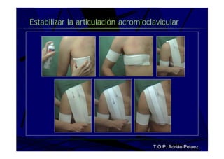 Vendaje Funcional Miembro Superior