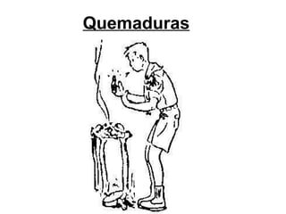 Quemaduras 