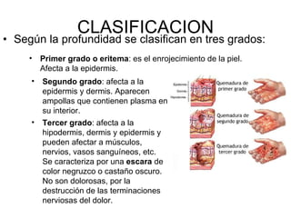 CLASIFICACION Según la profundidad se clasifican en tres grados: Primer grado o eritema : es el enrojecimiento de la piel. Afecta a la epidermis.  Segundo grado : afecta a la epidermis y dermis. Aparecen ampollas que contienen plasma en su interior.  Tercer grado : afecta a la hipodermis, dermis y epidermis y pueden afectar a músculos, nervios, vasos sanguíneos, etc. Se caracteriza por una  escara  de color negruzco o castaño oscuro. No son dolorosas, por la destrucción de las terminaciones nerviosas del dolor.  