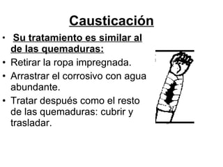 Causticación Su tratamiento es similar al de las quemaduras: Retirar la ropa impregnada.  Arrastrar el corrosivo con agua abundante.  Tratar después como el resto de las quemaduras: cubrir y trasladar.  