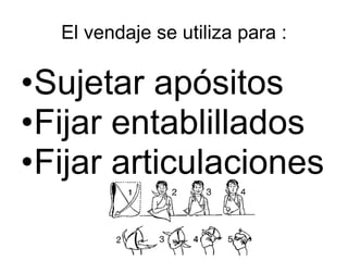 El vendaje se utiliza para : Sujetar apósitos  Fijar entablillados  Fijar articulaciones 