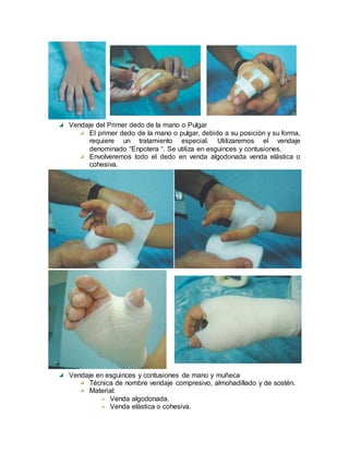 Vendaje del Primer dedo de la mano o Pulgar
El primer dedo de la mano o pulgar, debido a su posición y su forma,
requiere un tratamiento especial. Utilizaremos el vendaje
denominado “Enpotera “. Se utiliza en esguinces y contusiones.
Envolveremos todo el dedo en venda algodonada venda elástica o
cohesiva.
Vendaje en esguinces y contusiones de mano y muñeca
Técnica de nombre vendaje compresivo, almohadillado y de sostén.
Material:
Venda algodonada.
Venda elástica o cohesiva.
 