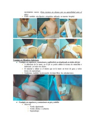 movimientos suaves. (Esta tecnica en desuso por su agresibidad ante el
niio.)
Existe también otra fijación ortopédica utilizada en nuestro hospital.
Vendajes en Miembros Inferiores
Vendajes en esguinces, contusiones y epfisiolisis no desplazads en dedos del pie
A diferencia de la mano, en el pie se podrá utilizar la técnica de sindactilia o
imbricado en todos los dedos.
El material a utilizar es el mismo que en la mano: un trozo de gasa y varios
trozos de esparadrapo.
Tendremos también la precaución de dejar libres las articulaciones.
Vendajes en esguinces y contusiones en pie y tobillo
Material.
Venda algodonada
Venda elástica o cohesiva
Esparadrapo
 