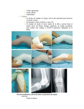 Venda algodonada
Venda elástica
Esparadrapo
Técnica:
La técnica de vendaje en Espiga será la más adecuada para favorecer
el retomo venoso.
El abordaje se hará en flexión a unos 30º.
El vendaje irá desde el tercio medio de la tibia y peroné hasta el
primer tercio del fémur. Siempre seguiremos un sentido ascendente
para realizar este vendaje y NUNCA bajaremos, finalizando en el
fémur.
Técnica de fijación y alivio del dolor en fracturas de cadera
Material:
Férula de Braun
 