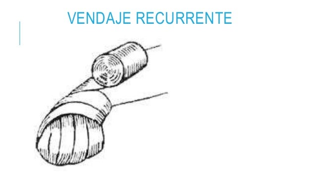 Resultado de imagen para imagenes de vendaje recurrente