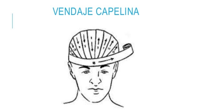 Vendajes
