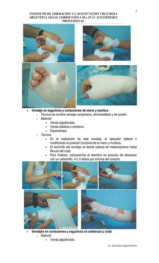 INSTITUTO DE FORMACION Y CAPACIT7ACION CRUZ ROJA
ARGENTINA FILIAL CORRIENTES I-30 e IT-11 ENFERMERIA
PROFESIONAL
• Vendaje en esguinces y contusiones de mano y muñeca
o Técnica de nombre vendaje compresivo, almohadillado y de sostén.
o Material:
 Venda algodonada.
 Venda elástica o cohesiva.
 Esparadrapo.
o Técnica.
 En la realización de este vendaje, el operador deberá ir
modificando la posición funcional de la mano y muñeca.
 El recorrido del vendaje va desde cabeza de metacarpianos hasta
flexura del codo.
 Para finalizar, colocaremos el miembro en posición de descanso
con un cabestrillo, 4 ó 5 dedos por encima del corazón.
• Vendajes en contusiones y esguinces en antebrazo y codo
o Material:
 Venda algodonada.
Lic. González Jorge Antonio
7
 