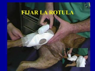 FIJAR LA ROTULA
 
