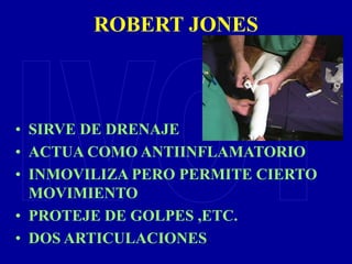 ROBERT JONES
• SIRVE DE DRENAJE
• ACTUA COMO ANTIINFLAMATORIO
• INMOVILIZA PERO PERMITE CIERTO
MOVIMIENTO
• PROTEJE DE GOLPES ,ETC.
• DOS ARTICULACIONES.
 