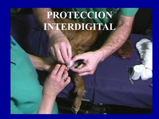PROTECCION
INTERDIGITAL
 