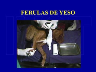 FERULAS DE YESO
 