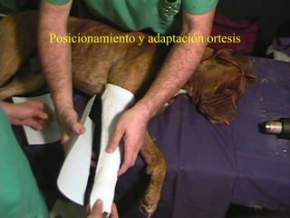 Posicionamiento y adaptación ortesis
 