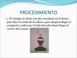 Cabeza De 3 Pulgadas Al Por Menor Con Vendaje Para El De Con Cabeza De 3 Pulgadas Al Por Menor Con Vendaje Para El De Con