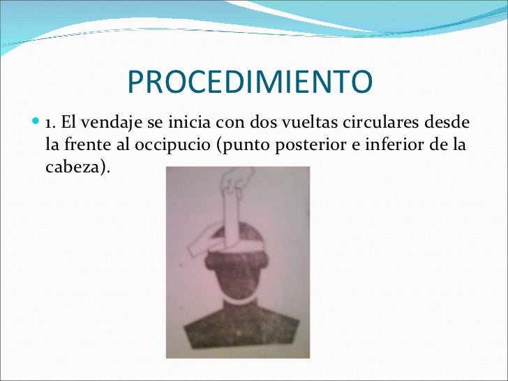 El aumento de las venas el miembro viril