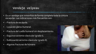Vendaje velpeau
▪ Es un vendaje que inmoviliza de forma completa toda la cintura
escapular. Las indicaciones más frecuentes son:
▪ - Fractura de escápula.
▪ - Luxación gleno-humeral.
▪ - Fractura del cuello humeral sin desplazamiento.
▪ - Esguince acromio-clavicular (grado I).
▪ - Subluxación acromio-clavicular (grado II).
▪ - Algunas fracturas de húmero
 