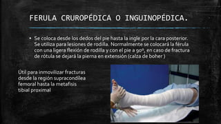 FERULA CRUROPÉDICA O INGUINOPÉDICA.
▪ Se coloca desde los dedos del pie hasta la ingle por la cara posterior.
Se utiliza para lesiones de rodilla. Normalmente se colocará la férula
con una ligera flexión de rodilla y con el pie a 90º, en caso de fractura
de rótula se dejará la pierna en extensión (calza de boher )
Útil para inmovilizar fracturas
desde la región supracondílea
femoral hasta la metafisis
tibial proximal
 