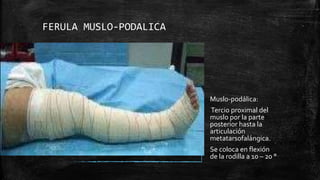 FERULA MUSLO-PODALICA
Muslo-podálica:
Tercio proximal del
muslo por la parte
posterior hasta la
articulación
metatarsofalángica.
Se coloca en flexión
de la rodilla a 10 – 20 °
 