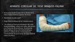 APARATO CIRCULAR DE YESO BRAQUIO-PALMAR
▪ Inmoviliza desde la base de los dedos de la
mano hasta el tercio superior de brazo.
▪ Mantener el codo a 90º.
▪ Dejar libre la cabeza de los metatarsianos
▪ : Se utiliza en fracturas alrededor del codo
(supracondíleas, cabeza de radio, olécranon)
y en fracturas de antebrazo. Se extiende
desde debajo de la axila hasta el pliegue
palmar y cabeza de los metacarpianos,
manteniendo las posiciones de seguridad de
codo y muñeca.
 