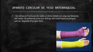APARATO CIRCULAR DE YESO ANTEBRAQUIAL
▪ : Se utiliza en fracturas de radio y cúbito distal y en algunas lesiones
del carpo. Se extiende justo por debajo del codo hasta el pliegue
palmar dejando el pulgar libre.
 