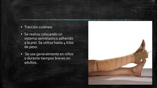 ▪ Tracción cutánea:
▪ Se realiza colocando un
sistema semielastico adherido
a la piel. Se utiliza hasta 4 kilos
de peso.
▪ Se usa generalmente en niños
o durante tiempos breves en
adultos.
 