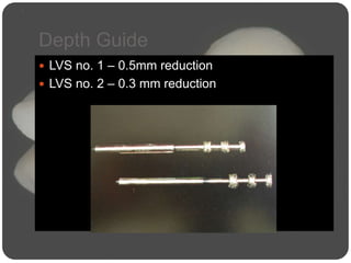 Depth Guide
 LVS no. 1 – 0.5mm reduction
 LVS no. 2 – 0.3 mm reduction
 