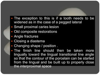  The exception to this is if a tooth needs to be
widened as in the case of a pegged lateral
 Small proximal caries lesion
 Old composite restorations
 Angle fractures
 Closing a diastema
 Changing shape / position .
 The finish line should then be taken more
lingually toward the lingual transitional line angle
so that the contour of the porcelain can be started
from the lingual and be built up to properly close
the interproximal space
 