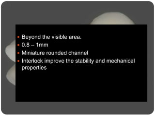  Beyond the visible area.
 0.8 – 1mm
 Miniature rounded channel
 Interlock improve the stability and mechanical
properties
 