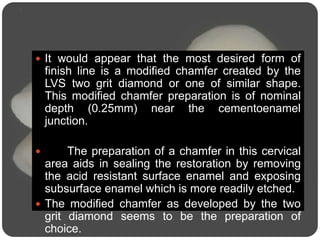  It would appear that the most desired form of
finish line is a modified chamfer created by the
LVS two grit diamond or one of similar shape.
This modified chamfer preparation is of nominal
depth (0.25mm) near the cementoenamel
junction.
 The preparation of a chamfer in this cervical
area aids in sealing the restoration by removing
the acid resistant surface enamel and exposing
subsurface enamel which is more readily etched.
 The modified chamfer as developed by the two
grit diamond seems to be the preparation of
choice.
 