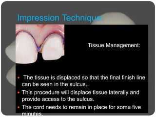 Impression Technique:

 Tissue Management:
 The tissue is displaced so that the final finish line
can be seen in the sulcus..
 This procedure will displace tissue laterally and
provide access to the sulcus.
 The cord needs to remain in place for some five
minutes.
 