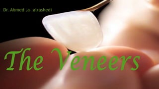 The Veneers

Dr. Ahmed .a .alrashedi

 