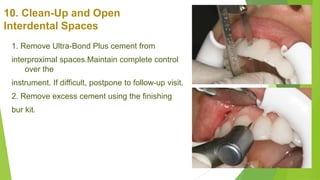 10. Clean-Up and Open
Interdental Spaces
1. Remove Ultra-Bond Plus cement from
interproximal spaces.Maintain complete cont...