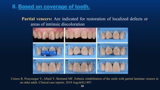 22
II. Based on coverage of tooth.
Partial veneers: Are indicated for restoration of localized defects or
areas of intrinsic discoloration
Ceinos R, Pouyssegur V, Allard Y, Bertrand MF. Esthetic rehabilitation of the smile with partial laminate veneers in
an older adult. Clinical case reports. 2018 Aug;6(8):1407.
 