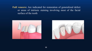 23
Full veneers: Are indicated for restoration of generalized defect
or areas of intrinsic staining involving most of the facial
surface of the tooth
 