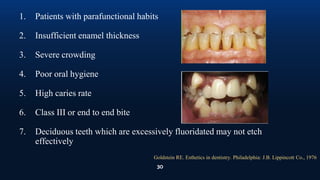 30
1. Patients with parafunctional habits
2. Insufficient enamel thickness
3. Severe crowding
4. Poor oral hygiene
5. High caries rate
6. Class III or end to end bite
7. Deciduous teeth which are excessively fluoridated may not etch
effectively
Goldstein RE. Esthetics in dentistry. Philadelphia: J.B. Lippincott Co., 1976
 