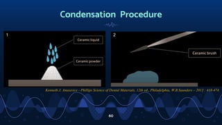 Condensation Procedure
60
1 2
Kenneth J. Anusavice - Phillips Science of Dental Materials, 12th ed., Philadelphia, W.B.Saunders – 2013 : 418-474.
 