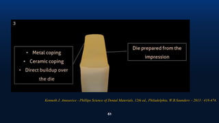 61
3
Kenneth J. Anusavice - Phillips Science of Dental Materials, 12th ed., Philadelphia, W.B.Saunders – 2013 : 418-474.
 