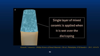 62
4
Kenneth J. Anusavice - Phillips Science of Dental Materials, 12th ed., Philadelphia, W.B.Saunders – 2013 : 418-474.
 