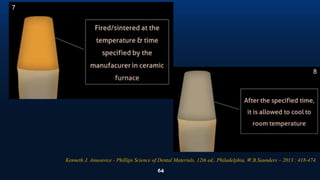 64
7
8
Kenneth J. Anusavice - Phillips Science of Dental Materials, 12th ed., Philadelphia, W.B.Saunders – 2013 : 418-474.
 