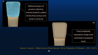 65
9
10
Kenneth J. Anusavice - Phillips Science of Dental Materials, 12th ed., Philadelphia, W.B.Saunders – 2013 : 418-474.
 