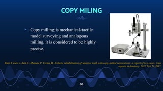 ▹ Copy milling is mechanical-tactile
model surveying and analogous
milling, it is considered to be highly
precise.
66
Rani S, Devi J, Jain C, Mutneja P, Verma M. Esthetic rehabilitation of anterior teeth with copy-milled restorations: a report of two cases. Case
reports in dentistry. 2017 Feb 23;2017.
 