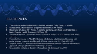REFERENCES
72
1. The Science and Art of Porcelain Laminate Veneers; Galip Gurel; 1st edition.
2. Sturdevant’s Art and science of operative dentistry, Fifth edition.
3. Rosenstiel SF, Land MF, Walter R, editors. Contemporary fixed prosthodontics-e-
book. Elsevier Health Sciences; 2022 Jun 22.
4. Sandesh M Mayekar , Shades of a colour – illusion or reality?. DCNA. January 2001, 45 (1)
155 -173.
5. Ceinos R, Pouyssegur V, Allard Y, Bertrand MF. Esthetic rehabilitation of the smile with
partial laminate veneers in an older adult. Clinical case reports. 2018 Aug;6(8):1407.
6. Magne P, Belser UC. Bonded Porcelain Restorations in the Anterior Dentition-a Biomimetic
Approach. Chicago: Quintessence Publishing Co; 2002.
7. Goldstein RE. Esthetics in dentistry. Philadelphia: J.B. Lippincott Co., 1976
 