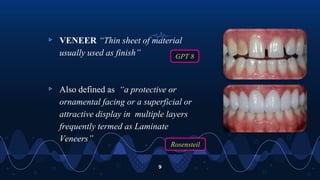▹ VENEER “Thin sheet of material
usually used as finish”
▹ Also defined as “a protective or
ornamental facing or a superficial or
attractive display in multiple layers
frequently termed as Laminate
Veneers”
9
GPT 8
Rosensteil
 