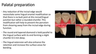 Enamel Modification VENEERS: YOUR SMILE'S BEST KEPT SECRET.pptx