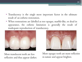 How To Reverse Translucent Teeth Veneers - preparation designs, indications | PPTX