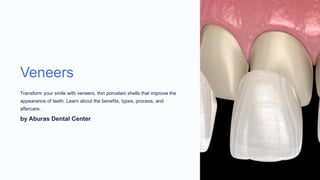 Veneers
Transform your smile with veneers, thin porcelain shells that improve the
appearance of teeth. Learn about the benefits, types, process, and
aftercare.
by Aburas Dental Center
 