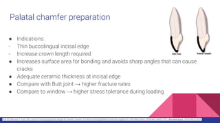 Palatal chamfer preparation
● Indications:
- Thin buccolingual incisal edge
- Increase crown length required
● Increases surface area for bonding and avoids sharp angles that can cause
cracks
● Adequate ceramic thickness at incisal edge
● Compare with Butt joint → higher fracture rates
● Compare to window → higher stress tolerance during loading
Chai SY, Bennani V, Aarts JM, Lyons K. Incisal preparation design for ceramic veneers: A critical review [published correction appears in J Am Dent Assoc. 2018 Mar;149(3):173]. J Am Dent Assoc. 2018;149(1):25-37.
 