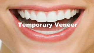 Temporary Veneer
 